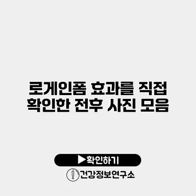 로게인폼 효과를 직접 확인한 전후 사진 모음